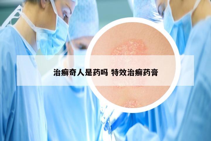 治癣奇人是药吗 特效治癣药膏