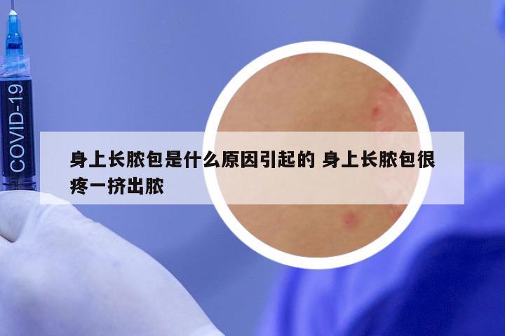 身上长脓包是什么原因引起的 身上长脓包很疼一挤出脓