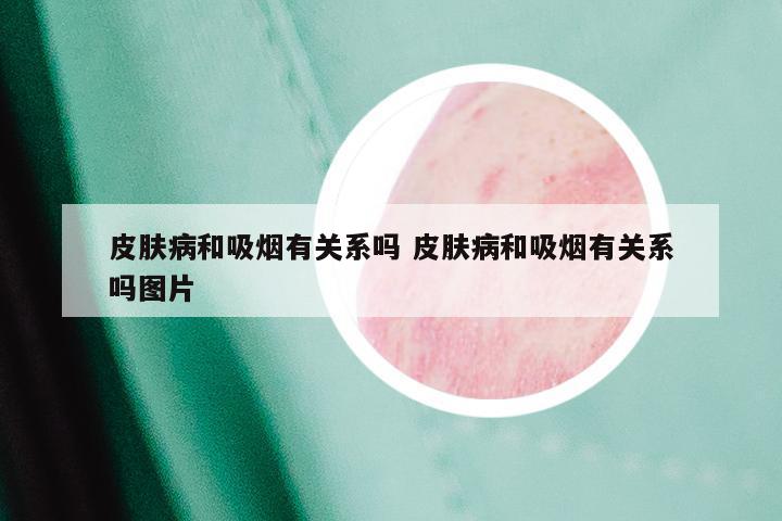 皮肤病和吸烟有关系吗 皮肤病和吸烟有关系吗图片