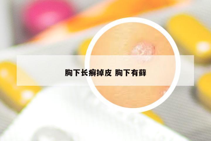 胸下长癣掉皮 胸下有藓