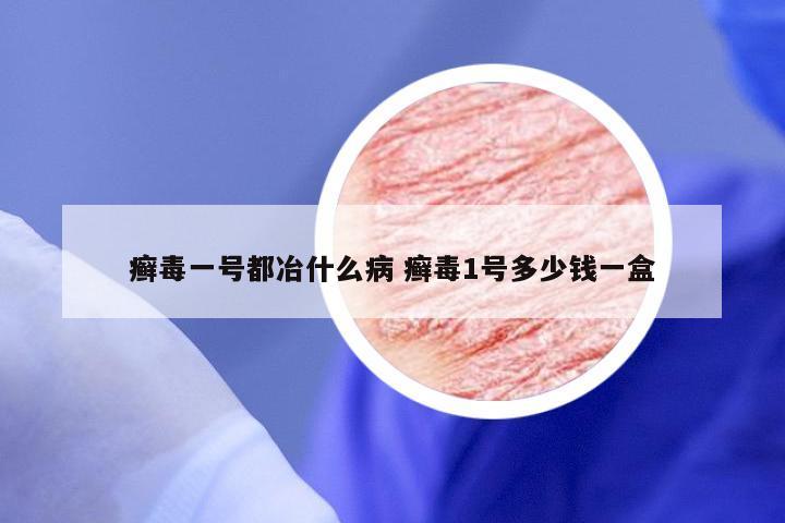 癣毒一号都冶什么病 癣毒1号多少钱一盒