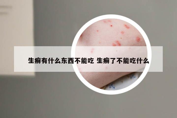 生癣有什么东西不能吃 生癣了不能吃什么
