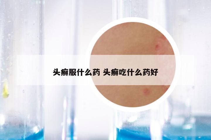 头癣服什么药 头癣吃什么药好