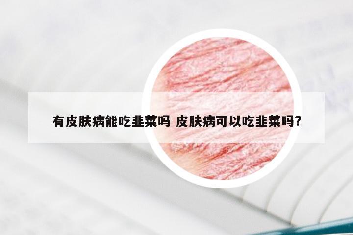 有皮肤病能吃韭菜吗 皮肤病可以吃韭菜吗?