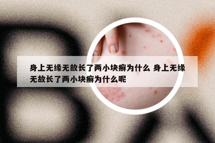 身上无缘无故长了两小块癣为什么 身上无缘无故长了两小块癣为什么呢