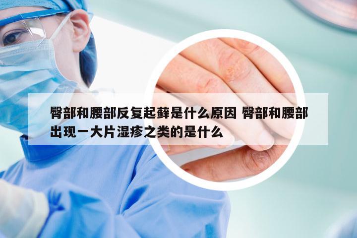 臀部和腰部反复起藓是什么原因 臀部和腰部出现一大片湿疹之类的是什么