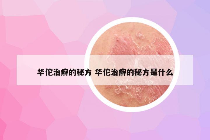 华佗治癣的秘方 华佗治癣的秘方是什么
