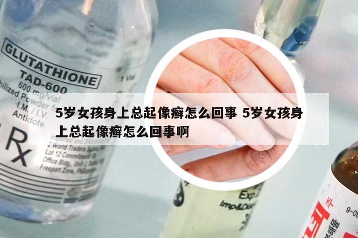 5岁女孩身上总起像癣怎么回事 5岁女孩身上总起像癣怎么回事啊