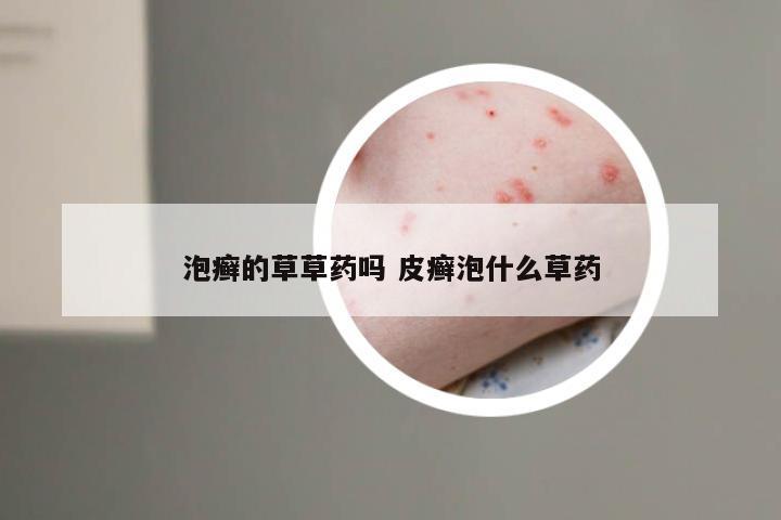 泡癣的草草药吗 皮癣泡什么草药