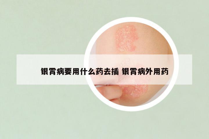 银霄病要用什么药去插 银霄病外用药