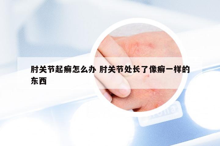 肘关节起癣怎么办 肘关节处长了像癣一样的东西