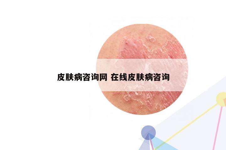 皮肤病咨询网 在线皮肤病咨询