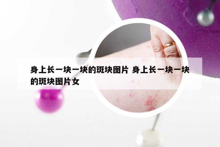 身上长一块一块的斑块图片 身上长一块一块的斑块图片女