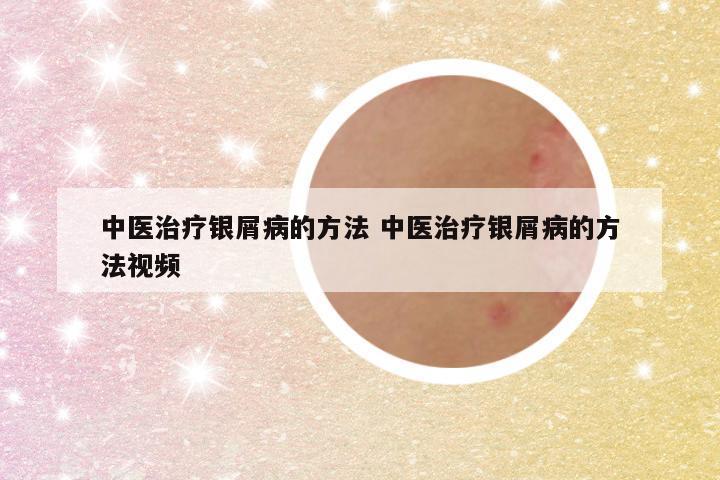 中医治疗银屑病的方法 中医治疗银屑病的方法视频