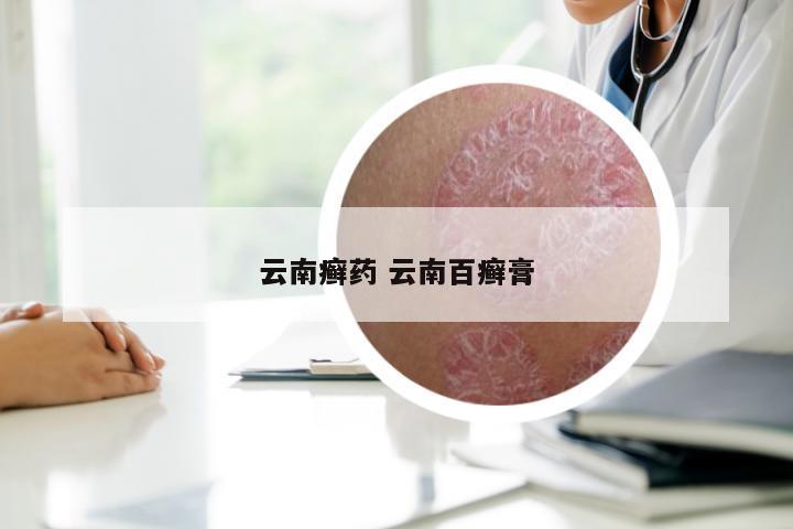 云南癣药 云南百癣膏