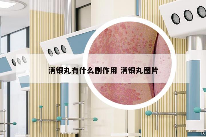 消银丸有什么副作用 消银丸图片