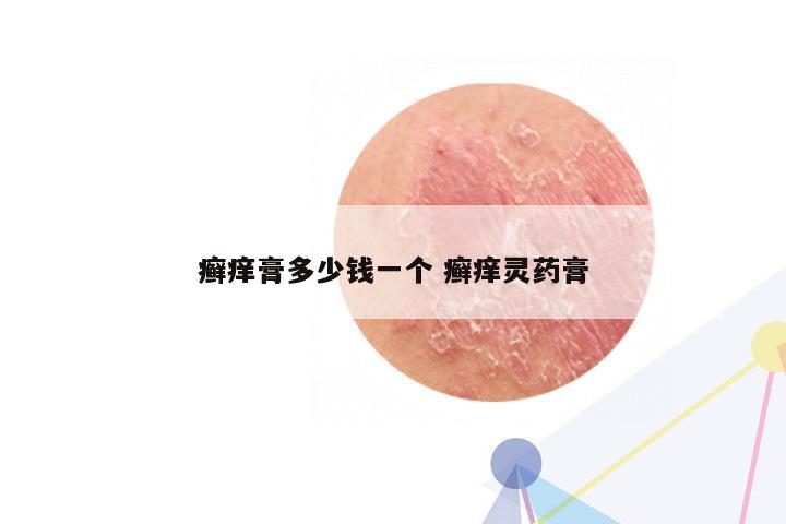 癣痒膏多少钱一个 癣痒灵药膏
