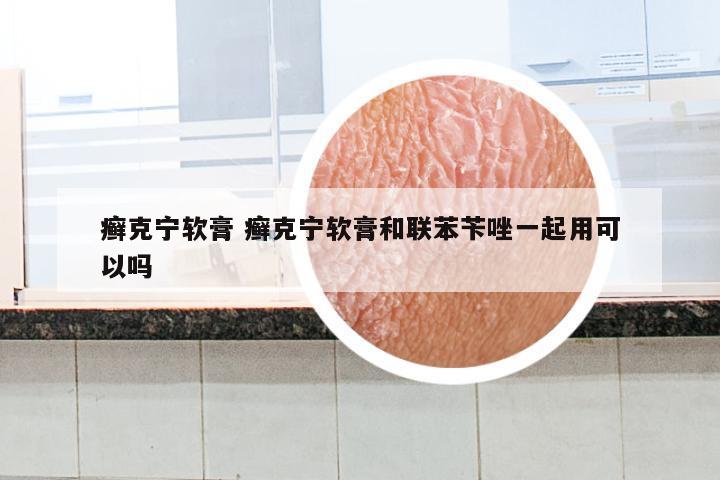 癣克宁软膏 癣克宁软膏和联苯苄唑一起用可以吗