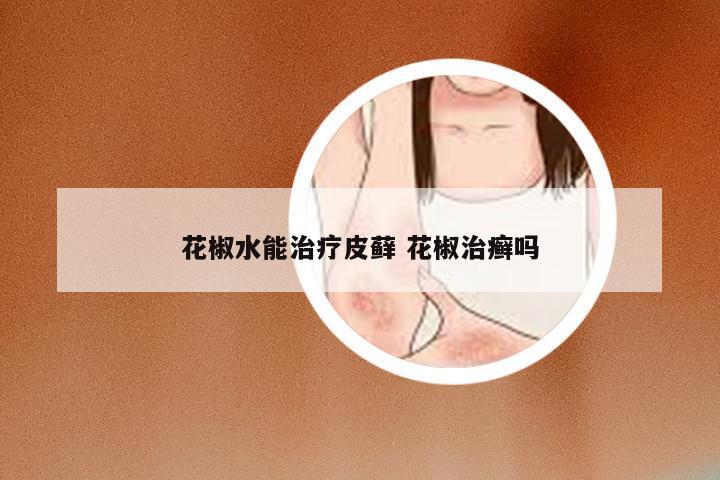 花椒水能治疗皮藓 花椒治癣吗
