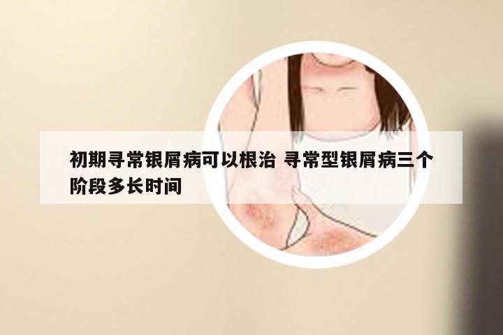 初期寻常银屑病可以根治 寻常型银屑病三个阶段多长时间