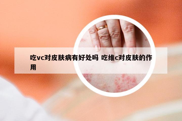 吃vc对皮肤病有好处吗 吃维c对皮肤的作用