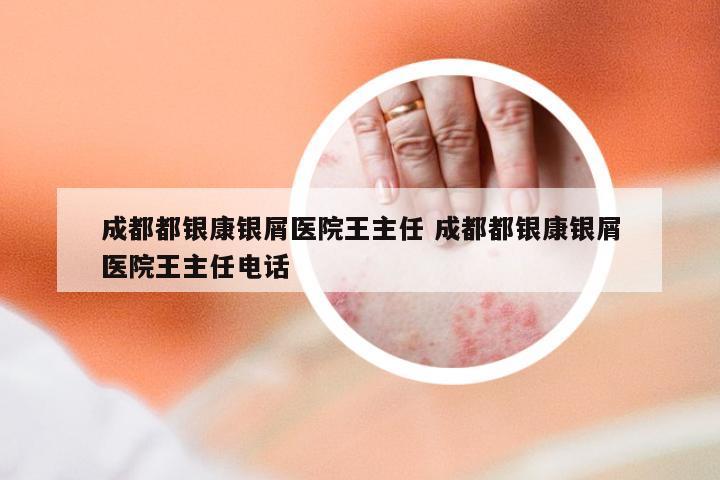 成都都银康银屑医院王主任 成都都银康银屑医院王主任电话