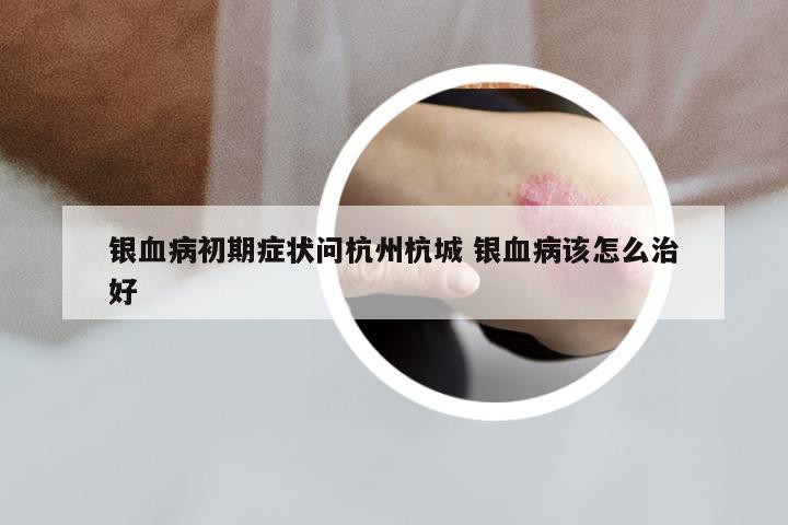 银血病初期症状问杭州杭城 银血病该怎么治好