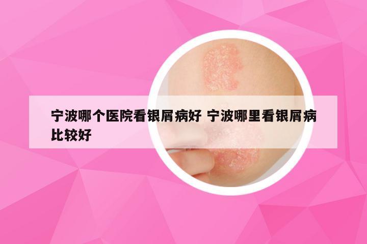 宁波哪个医院看银屑病好 宁波哪里看银屑病比较好