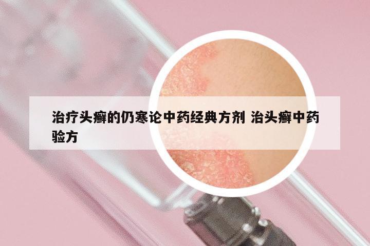 治疗头癣的仍寒论中药经典方剂 治头癣中药验方