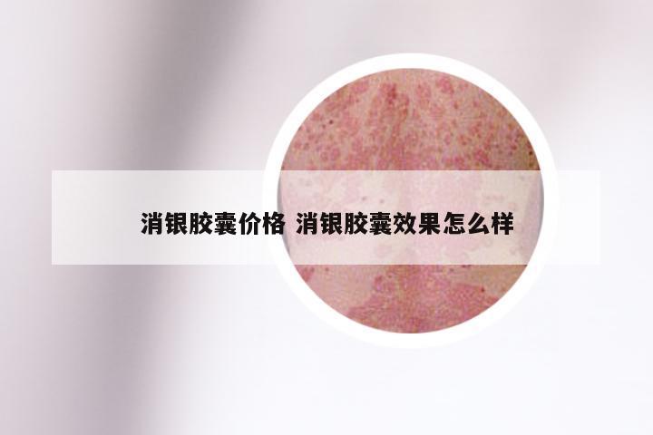 消银胶囊价格 消银胶囊效果怎么样