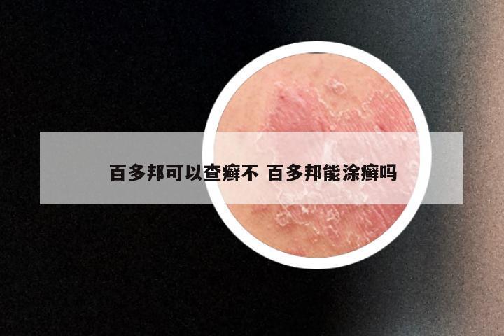 百多邦可以查癣不 百多邦能涂癣吗