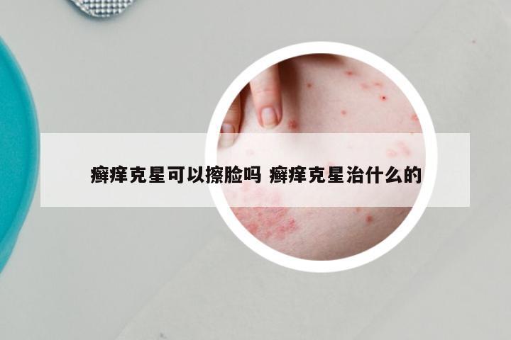 癣痒克星可以擦脸吗 癣痒克星治什么的