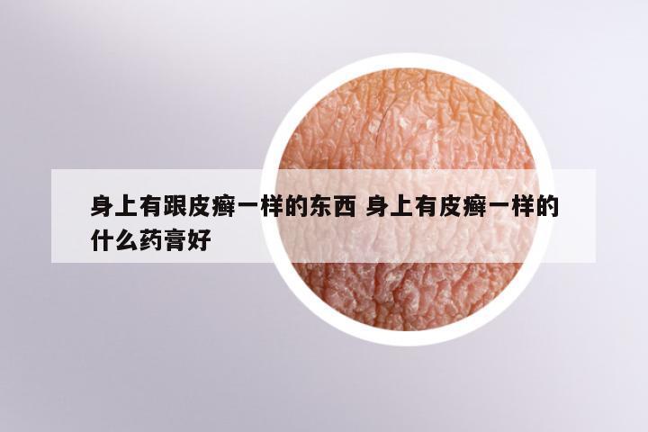 身上有跟皮癣一样的东西 身上有皮癣一样的什么药膏好