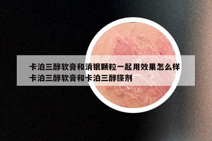 卡泊三醇软膏和消银颗粒一起用效果怎么样 卡泊三醇软膏和卡泊三醇搽剂