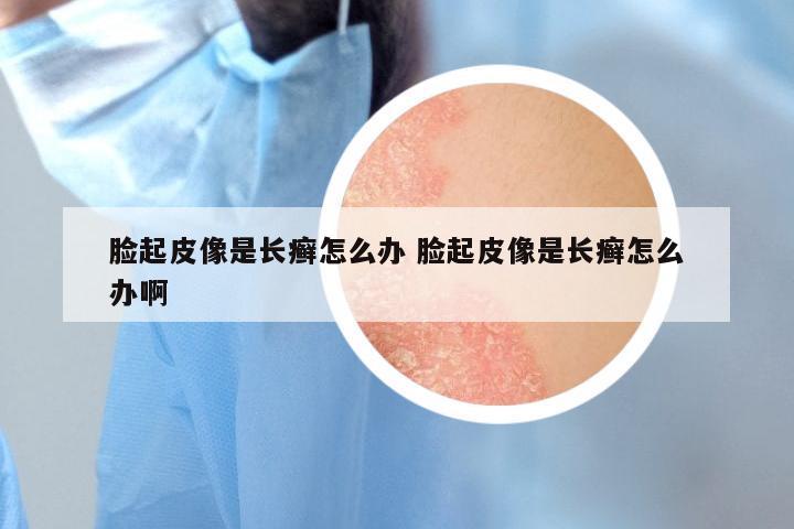 脸起皮像是长癣怎么办 脸起皮像是长癣怎么办啊