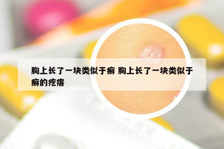 胸上长了一块类似于癣 胸上长了一块类似于癣的疙瘩