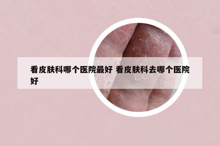 看皮肤科哪个医院最好 看皮肤科去哪个医院好