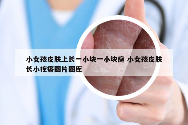 小女孩皮肤上长一小块一小块癣 小女孩皮肤长小疙瘩图片图库