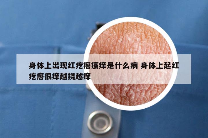 身体上出现红疙瘩瘙痒是什么病 身体上起红疙瘩很痒越挠越痒