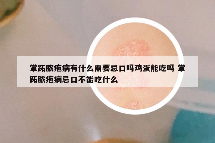 掌跖脓疱病有什么需要忌口吗鸡蛋能吃吗 掌跖脓疱病忌口不能吃什么