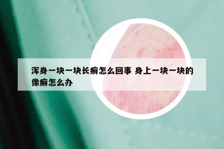 浑身一块一块长癣怎么回事 身上一块一块的像癣怎么办