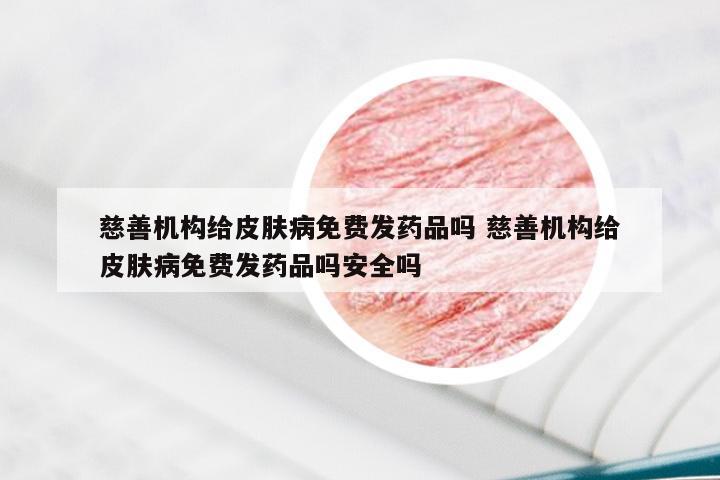慈善机构给皮肤病免费发药品吗 慈善机构给皮肤病免费发药品吗安全吗