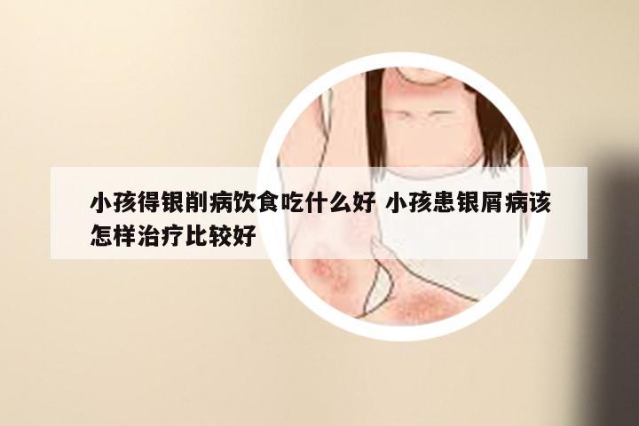 小孩得银削病饮食吃什么好 小孩患银屑病该怎样治疗比较好