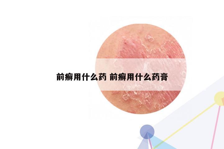 前癣用什么药 前癣用什么药膏