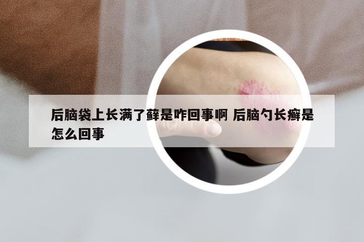后脑袋上长满了藓是咋回事啊 后脑勺长癣是怎么回事
