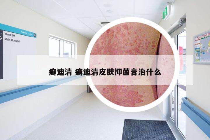癣迪清 癣迪清皮肤抑菌膏治什么