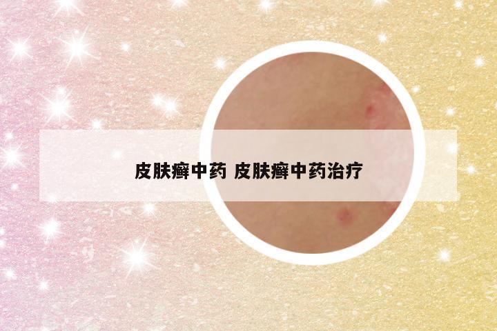 皮肤癣中药 皮肤癣中药治疗