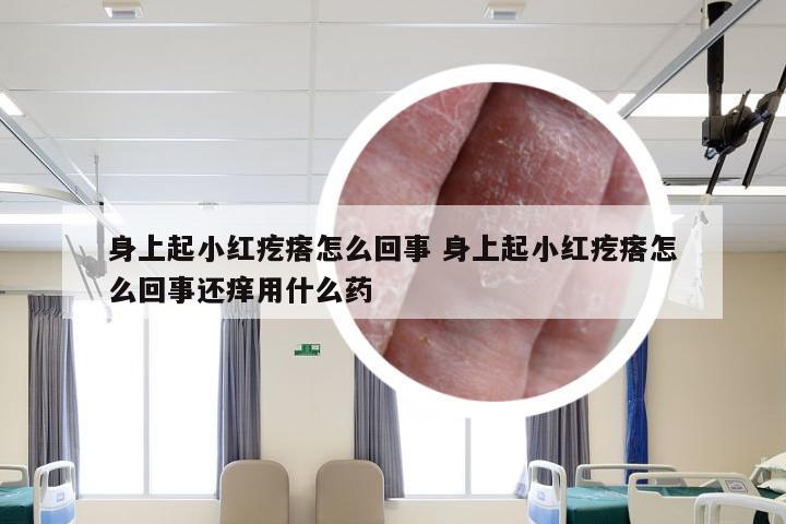 身上起小红疙瘩怎么回事 身上起小红疙瘩怎么回事还痒用什么药