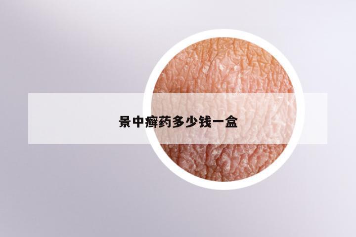 景中癣药多少钱一盒