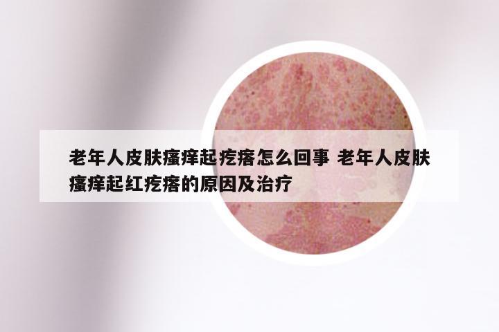 老年人皮肤瘙痒起疙瘩怎么回事 老年人皮肤瘙痒起红疙瘩的原因及治疗